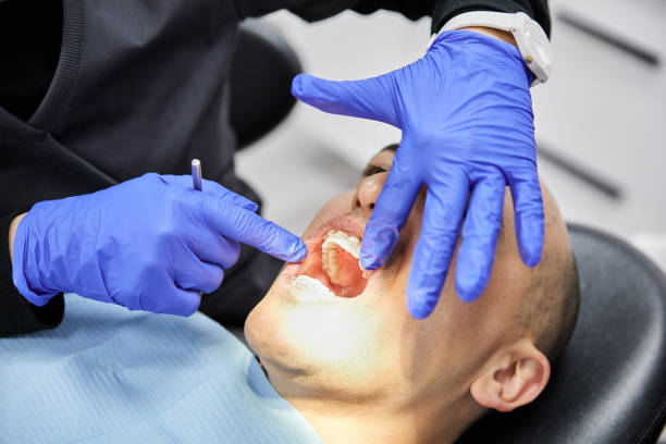 Best Emergency Treatment for Toothache in Rio Pinar, FL